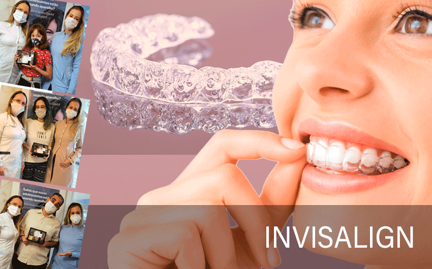IMAGEM-CARROSSEL-INVISALIGN.png