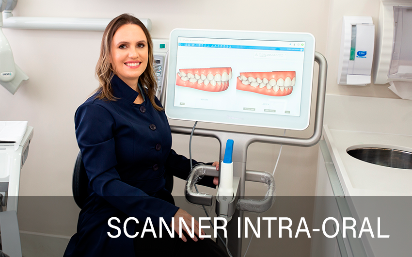 IMAGEM-CARROSSEL-SCANNER-INTRA-ORAL-NOVA.png