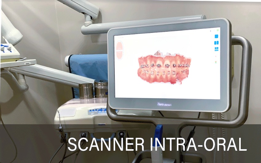 IMAGEM-CARROSSEL-SCANNER-INTRA-ORAL_edited.jpg